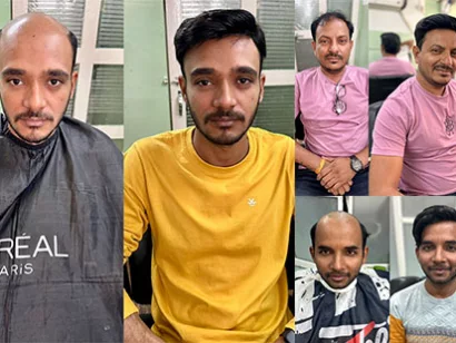 top hair replacement clinic Viman Nagar