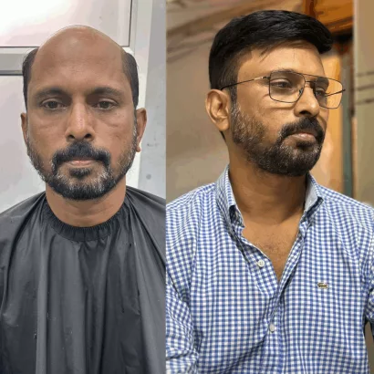 affordable hair wig shop in Pune